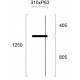 СТЕННА ЛАМПА SLIM LED 14W ЧЕРНА 3000K